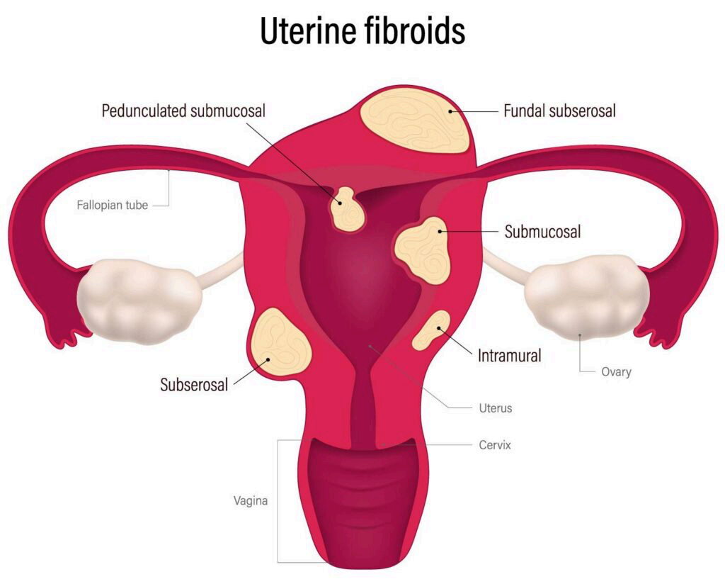 Laparoscopic surgery benefits